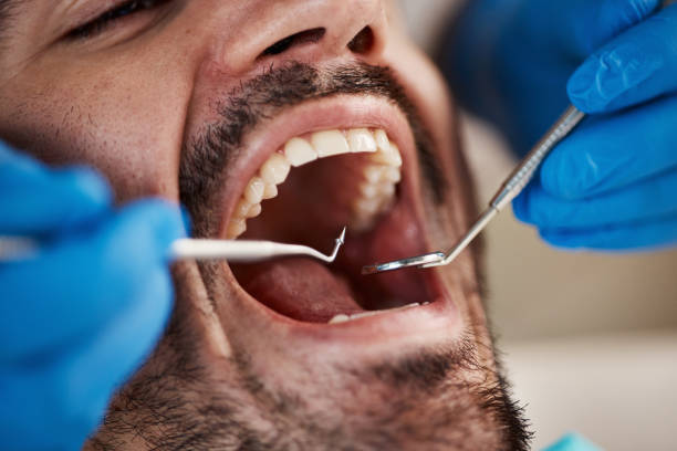 Best Emergency Root Canal Treatment in Alexandria, VA