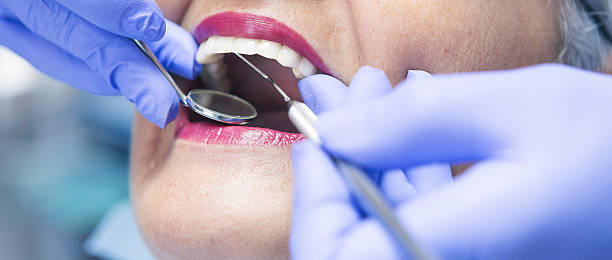 Best Emergency Dentist for Special Needs Patients in Alexandria, VA